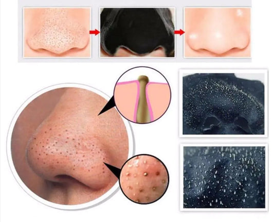 Activated Charcoal Blackhead Removal Mask and Strips